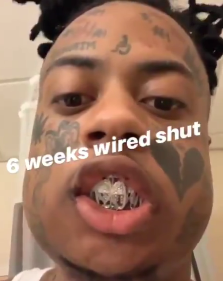 Boonk Instagram Deleted photo 15