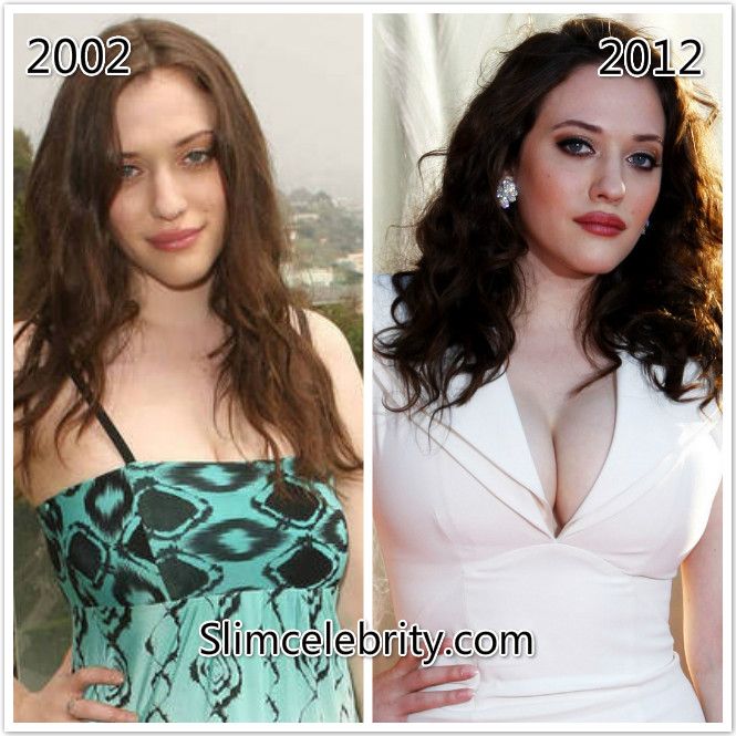 Are Kat Dennings Breasts Real photo 28