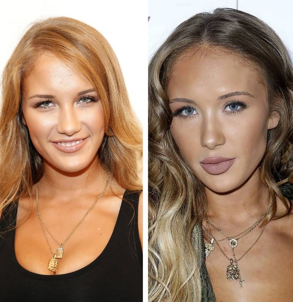 Niykee Heaton Before And After Surgery photo 4
