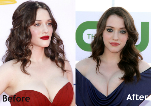 Are Kat Dennings Breasts Real photo 14
