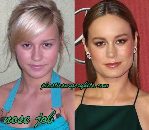 Brie Larson Breast Implants photo 10