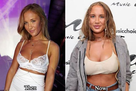 Niykee Heaton Before And After Surgery photo 12